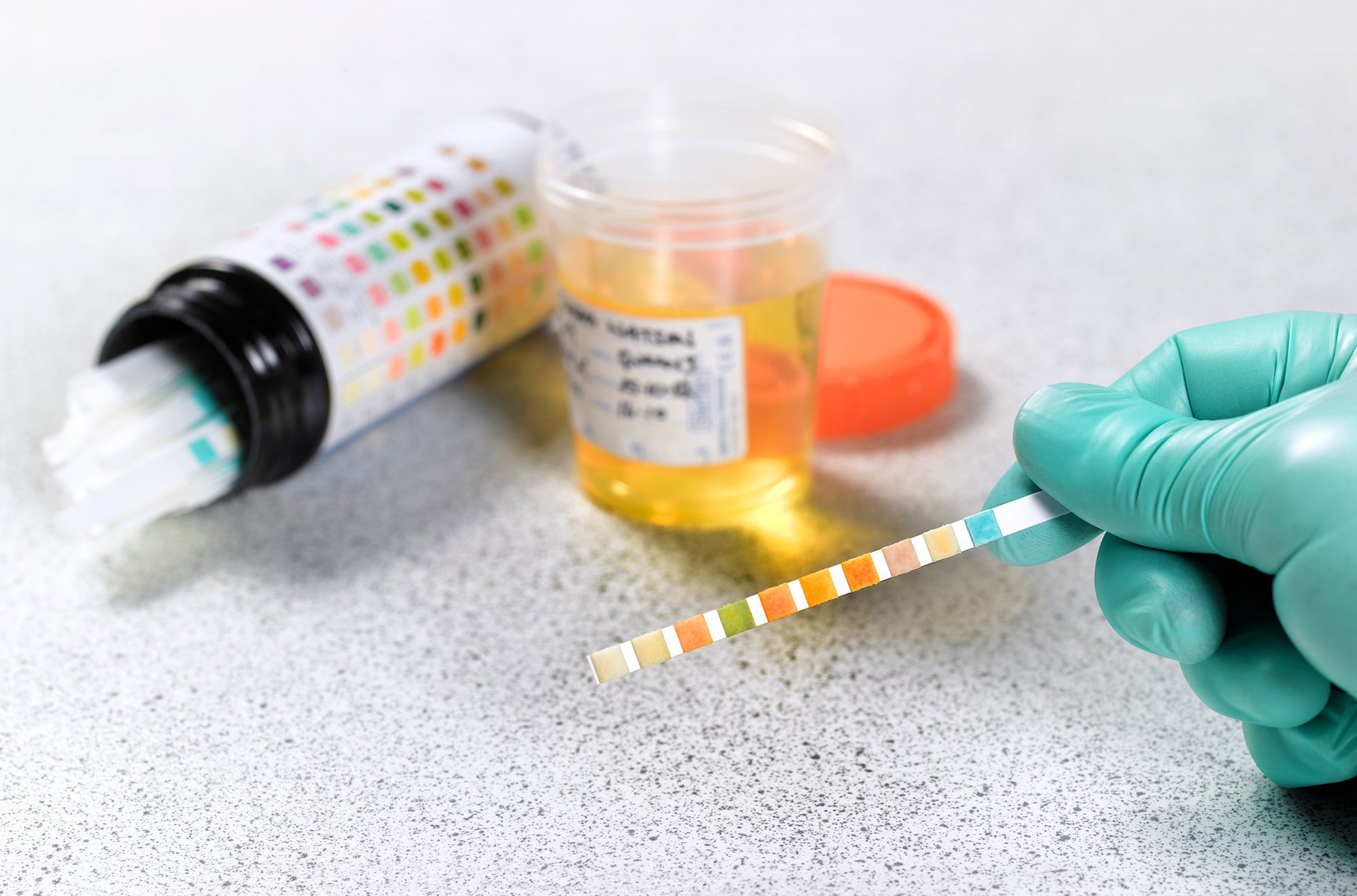 Urine 14 Panel Drug Test